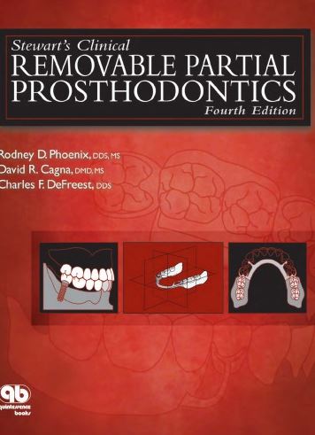 Stewart’s Clinical Removable Partial Prosthodontics 4th Edition Rodney D. Phoenix, ISBN-13: 978-0867154856