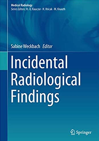 Incidental Radiological Findings Sabine Weckbach, ISBN-13: 978-3319425795